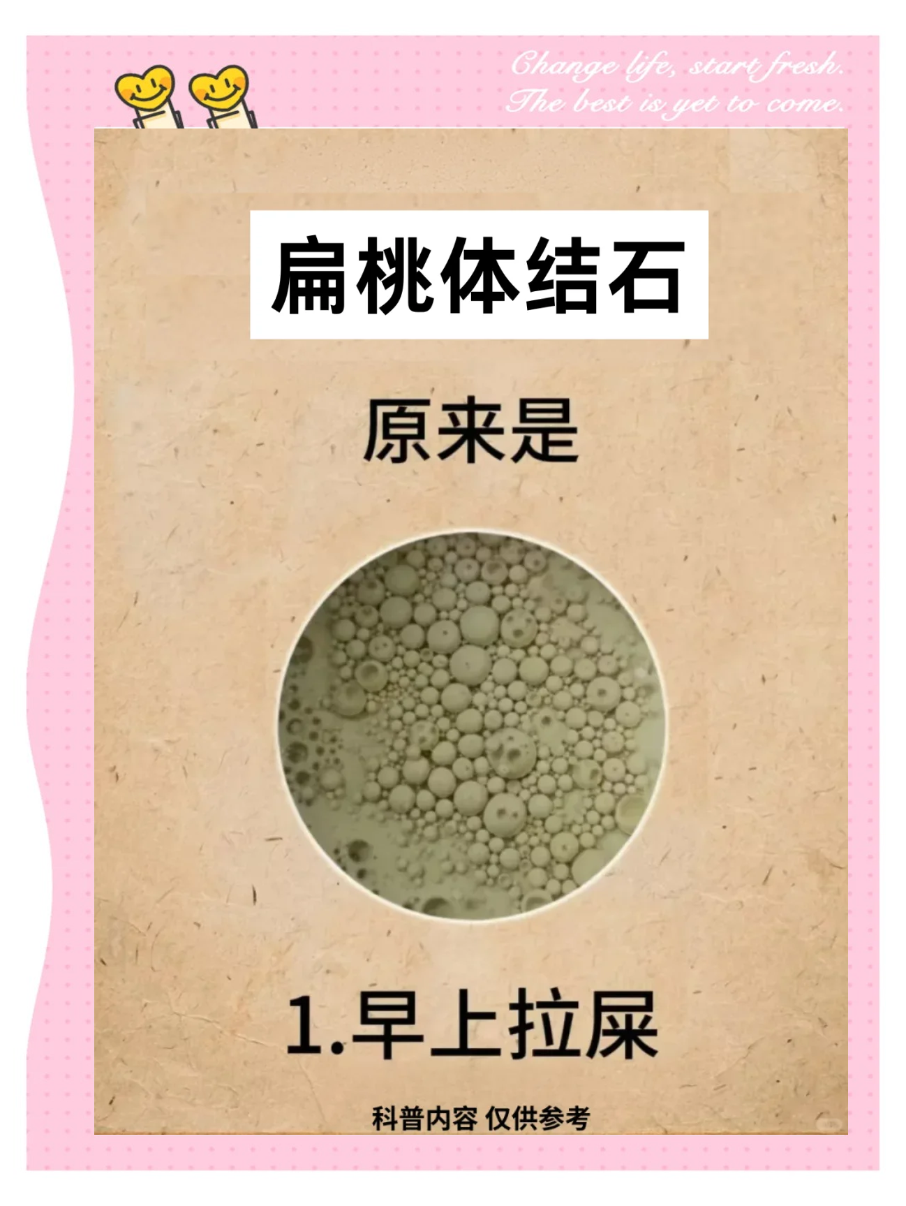 补钙为什么会结石为什么在线 补钙为什么会结石为什么在线